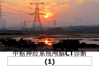 最新中枢神经系统颅脑CT诊断(1)课件PPT.ppt