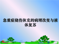 最新急重症烧伤休克的病理改变与液体复苏课件PPT.ppt