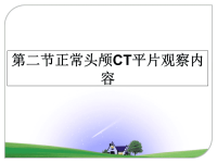 最新第二节正常头颅CT平片观察内容课件PPT.ppt